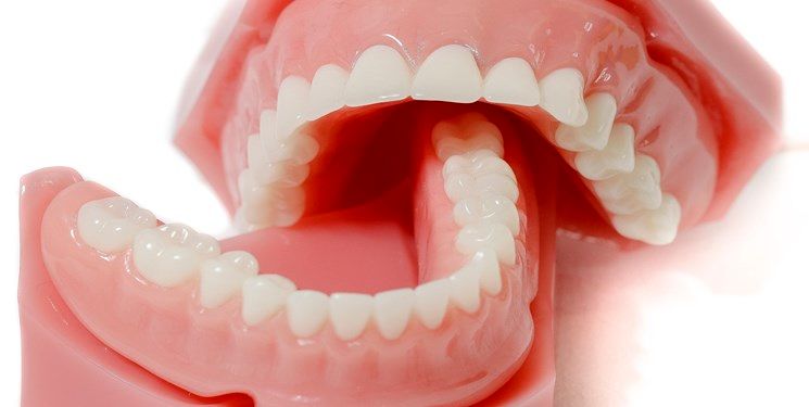 دندانسازی مروارید در تهران